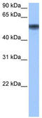 Methionyl Aminopeptidase 2 antibody, TA340142, Origene, Western Blot image 