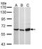 Calcium Voltage-Gated Channel Auxiliary Subunit Beta 1 antibody, LS-C109419, Lifespan Biosciences, Western Blot image 