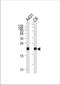 Ras antibody, TA328115, Origene, Western Blot image 