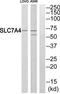 Solute Carrier Family 7 Member 4 antibody, TA314546, Origene, Western Blot image 