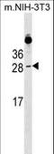 Ras-related protein Rab-39B antibody, LS-C158790, Lifespan Biosciences, Western Blot image 