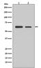 SMAD2 antibody, M00090-1, Boster Biological Technology, Western Blot image 