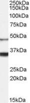 Succinate Dehydrogenase Complex Iron Sulfur Subunit B antibody, 46-345, ProSci, Western Blot image 
