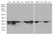 Succinate Dehydrogenase Complex Iron Sulfur Subunit B antibody, LS-C797066, Lifespan Biosciences, Western Blot image 