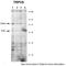 Transient Receptor Potential Cation Channel Subfamily V Member 5 antibody, TA331092, Origene, Western Blot image 