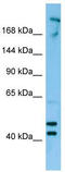CDC42 Binding Protein Kinase Beta antibody, TA338137, Origene, Western Blot image 