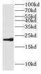 Hippocalcin Like 4 antibody, FNab03992, FineTest, Western Blot image 