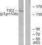 TEK Receptor Tyrosine Kinase antibody, PA5-38339, Invitrogen Antibodies, Western Blot image 