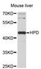 4-Hydroxyphenylpyruvate Dioxygenase antibody, STJ24077, St John