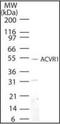 Activin A Receptor Type 1 antibody, orb87896, Biorbyt, Western Blot image 