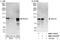 BTB Domain And CNC Homolog 1 antibody, NBP1-71814, Novus Biologicals, Western Blot image 
