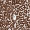 CAC antibody, HPA029863, Atlas Antibodies, Immunohistochemistry paraffin image 