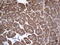 Dedicator of cytokinesis protein 8 antibody, LS-C789751, Lifespan Biosciences, Immunohistochemistry paraffin image 