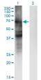 SLC4A4 antibody, H00008671-M01, Novus Biologicals, Western Blot image 