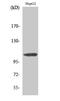 Endoplasmic reticulum aminopeptidase 1 antibody, STJ92971, St John