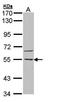 Calcium/Calmodulin Dependent Protein Kinase Kinase 2 antibody, orb73667, Biorbyt, Western Blot image 