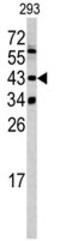 Lysine Methyltransferase 5A antibody, AP17740PU-N, Origene, Western Blot image 