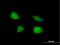 Telomerase RNA Component Interacting RNase antibody, H00079002-B01P, Novus Biologicals, Immunofluorescence image 