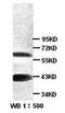 Kruppel Like Factor 8 antibody, orb77151, Biorbyt, Western Blot image 