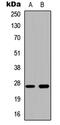 Cathepsin Z antibody, LS-B13419, Lifespan Biosciences, Western Blot image 