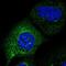 Chromosome 2 Open Reading Frame 76 antibody, HPA055362, Atlas Antibodies, Immunocytochemistry image 