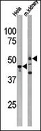 Protein Serine Kinase H1 antibody, 62-708, ProSci, Western Blot image 