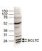 BAF Chromatin Remodeling Complex Subunit BCL7C antibody, CI1108, Boster Biological Technology, Western Blot image 