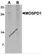 Motile Sperm Domain Containing 1 antibody, 7279, ProSci, Western Blot image 