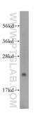 RAB1B, Member RAS Oncogene Family antibody, 17824-1-AP, Proteintech Group, Western Blot image 