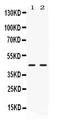 Nuclear Receptor Subfamily 2 Group F Member 6 antibody, PB10081, Boster Biological Technology, Western Blot image 