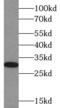 Collagen Triple Helix Repeat Containing 1 antibody, FNab02055, FineTest, Western Blot image 