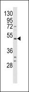 BKRB1 antibody, LS-C156783, Lifespan Biosciences, Western Blot image 