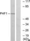 PHD Finger Protein 1 antibody, TA314336, Origene, Western Blot image 