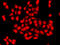 Calcium/Calmodulin Dependent Protein Kinase ID antibody, 22-996, ProSci, Immunofluorescence image 