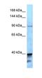 Kinesin-like protein KIF7 antibody, orb326405, Biorbyt, Western Blot image 