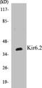 Potassium Voltage-Gated Channel Subfamily J Member 11 antibody, EKC1331, Boster Biological Technology, Western Blot image 
