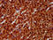 ETS Variant 5 antibody, LS-C680428, Lifespan Biosciences, Immunohistochemistry paraffin image 