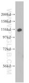 Myotubularin Related Protein 14 antibody, 14973-1-AP, Proteintech Group, Western Blot image 