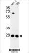 3,2-trans-enoyl-CoA isomerase, mitochondrial antibody, 63-848, ProSci, Western Blot image 