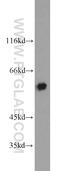 Histone acetyltransferase KAT5 antibody, 10827-1-AP, Proteintech Group, Western Blot image 