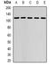 Dehydrogenase E1 And Transketolase Domain Containing 1 antibody, orb341485, Biorbyt, Western Blot image 