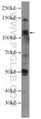 Tudor Domain Containing 5 antibody, 25239-1-AP, Proteintech Group, Western Blot image 