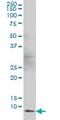 Barrier To Autointegration Factor 1 antibody, ab88464, Abcam, Western Blot image 