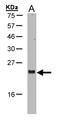ADP Ribosylation Factor Like GTPase 2 antibody, LS-B4071, Lifespan Biosciences, Western Blot image 