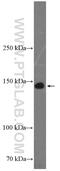 Platelet glycoprotein Ib alpha chain antibody, 12860-1-AP, Proteintech Group, Western Blot image 