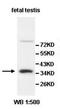 Aldo-Keto Reductase Family 1 Member E2 antibody, orb77546, Biorbyt, Western Blot image 