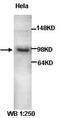 Protein Shroom2 antibody, orb77108, Biorbyt, Western Blot image 