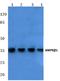 Protein Kinase AMP-Activated Non-Catalytic Subunit Beta 1 antibody, A03741, Boster Biological Technology, Western Blot image 