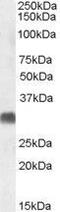 Steroid 5 Alpha-Reductase 2 antibody, GTX47547, GeneTex, Western Blot image 