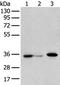 Dehydrogenase/Reductase X-Linked antibody, PA5-51221, Invitrogen Antibodies, Western Blot image 